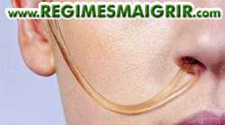 Insérer un tube naso-gastrique extrafin dans le nez n'est pas désagréable selon les promoteurs du régime