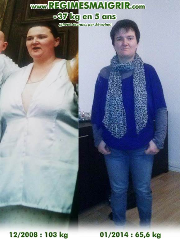 Séverine a maigri de plus de 37 kilogrammes avec un anneau gastrique et en mangeant plus équilibré