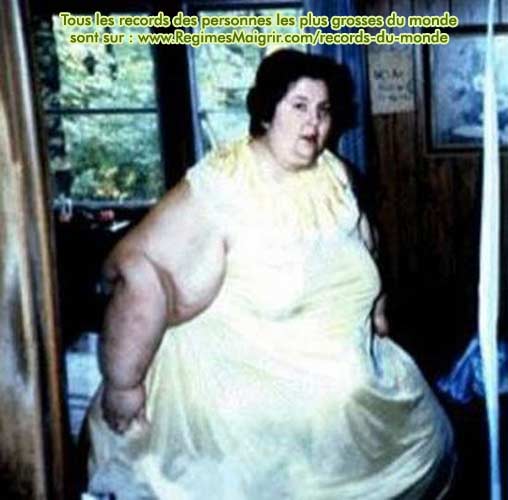 Rosalie Bradford reste la femme qui a le plus maigri de l'histoire, elle a russi  perdre 409 kilogrammes