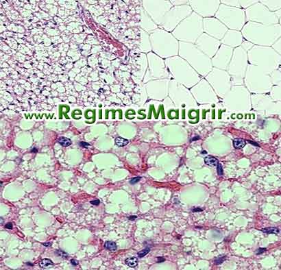 La graisse brune vue au microscope compare  la graisse blanche. Zoom sur la graisse brune en bas.