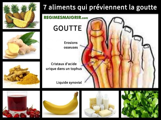 Voici sept aliments qui aident  prvenir la goutte