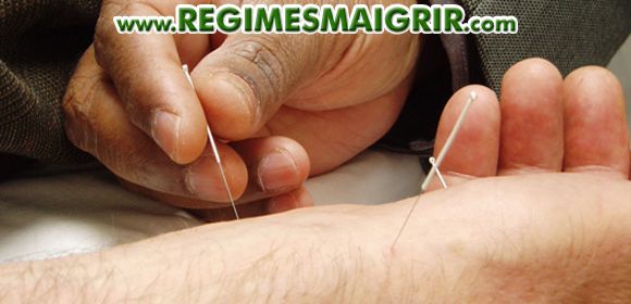 Un acupuncteur plante des aiguilles sur la main d'un patient