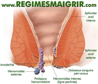 Schma explicatif des hmorrodes
