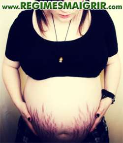 Une femme enceinte regarde les nombreuses vergetures rouges sur son ventre