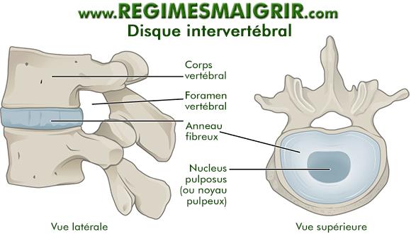 Vue latrale et suprieure du disque intervertbral